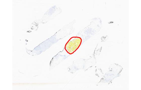 mindpeak_pr_ruo_02_annotation_subregion_analysis