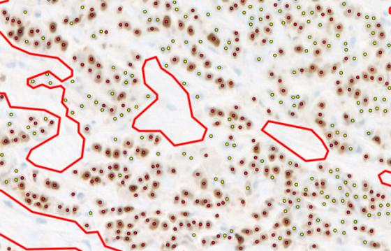 mindpeak_pr_ruo_04_cell_markup