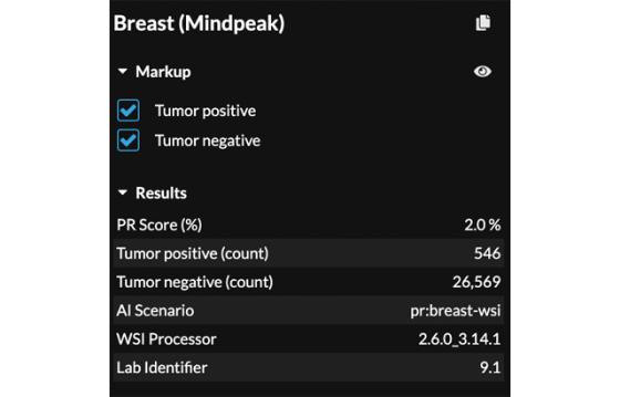 mindpeak_pr_ruo_05_score_results_panel