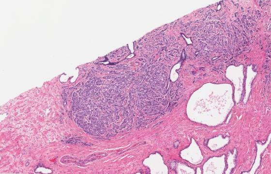 H&E_5x_prostate_1920x1230