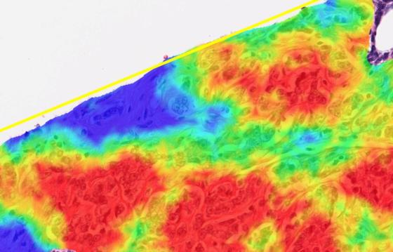 heatmap zoomed