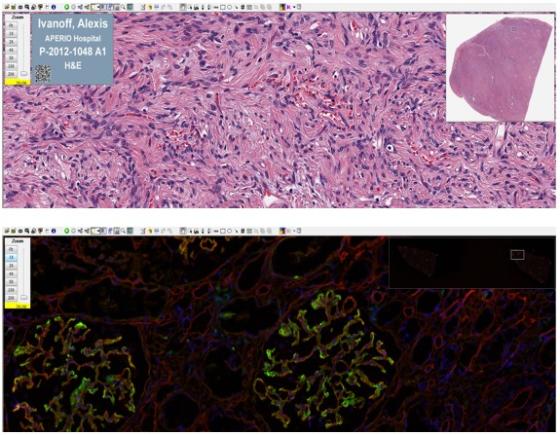 Aperio ImageScope - Logiciel de visualisation de lames en pathologie