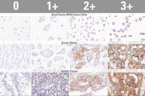 HER2 Control Slides and Tissue Staining