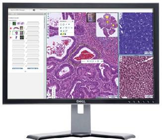 Aperio eSlide Manager – Complete Digital Pathology Management Software