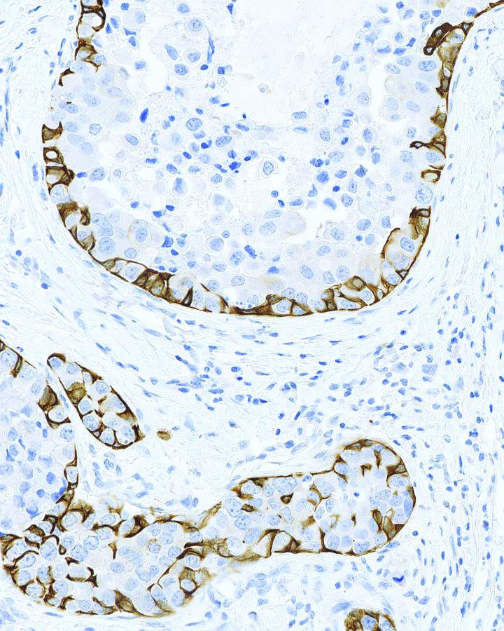 Choose Highly Definitive Antibodies for IHC