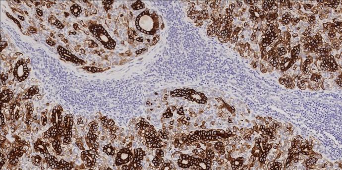 Leica Biosystems introduces new Novocastra HD antibody menu for Head and Neck Pathology