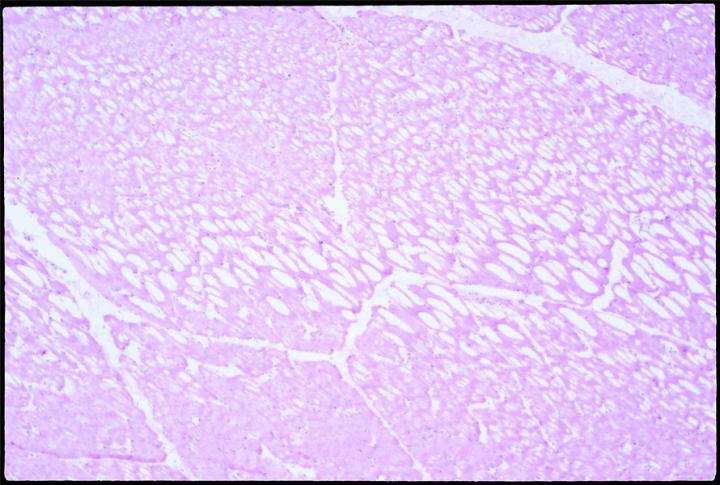 Fig. 1: Ice crystal artifact in a section of skeletal muscle