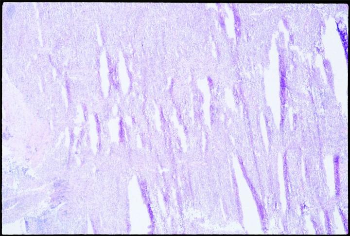 Fig. 2: Frozen section "shutters" caused by sectioning a block thar was too cold