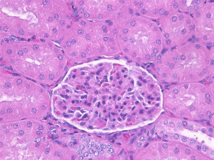 Figure 1: A paraffin section of kidney that has been fixed using neutral buffered formalin. This is an example of well-fixed tissue showing good nuclear and cytoplasmic morphology with minimal shrinkage showing clearly defined basement membranes and cell margins. Figure 1: A paraffin section of kidney that has been fixed using neutral buffered formalin. This is an example of well-fixed tissue showing good nuclear and cytoplasmic morphology with minimal shrinkage showing clearly defined basement membranes and cell margins.