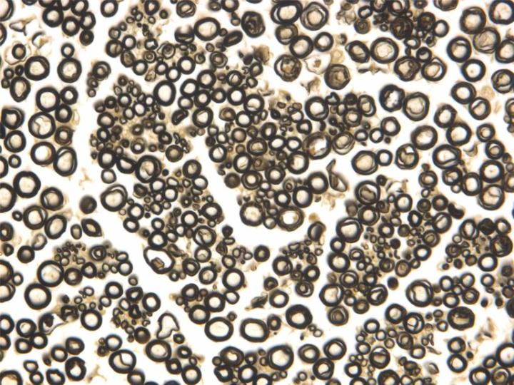 Figure 1: A transverse section of a peripheral nerve that has been fixed in osmium tetroxide (Flemming’s fluid). The myelin sheaths are preserved and stained black by this process. In this example a paraffin section has been prepared but excellent results can be achieved when polymerizing resins (epoxies or methacrylates) are used instead. Figure 1: A transverse section of a peripheral nerve that has been fixed in osmium tetroxide (Flemming’s fluid). The myelin sheaths are preserved and stained black by this process. In this example a paraffin section has been prepared but excellent results can be achieved when polymerizing resins (epoxies or methacrylates) are used instead.