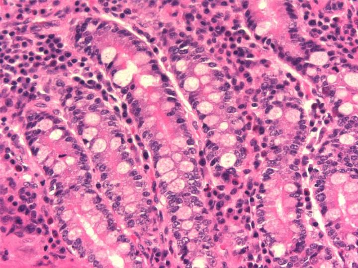 Figure 3: A paraffin section of the mucosa of small intestine that has been fixed in neutral buffered formalin, a cross-linking fixative. Nuclear and cytoplasmic preservation is satisfactory but some cellular shrinkage is present.