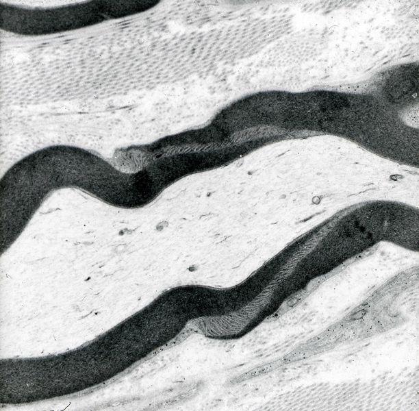 Figure 3: An electron micrograph showing a Schmidt-Lanterman incisure in a myelinated nerve fibre. This specimen was fixed in buffered glutaraldehyde, washed in buffer then given secondary fixation in buffered osmium tetroxide, a standard procedure when preparing specimens for transmission electron microscopy. The multiple layers of phospholipid membrane forming the myelin sheath are well-preserved by this procedure.