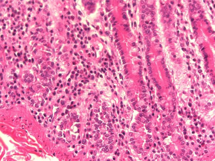 Figure 4: A paraffin section from the mucosa of small intestine that has been fixed in 95% ethanol, a denaturing fixative. While nuclear preservation is fair there is substantial shrinkage of cytoplasmic and extracellular elements. Compare the morphology demonstrated here with that shown in Figure 3, which was photographed at the same magnification.