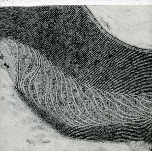 Figure 4: The Schmidt-Lanterman incisure in a myelinated nerve fibre shown at a higher magnification than in Figure 2. The multiple layers of phospholipid membrane forming the myelin sheath are well-preserved by the glutaraldehyde/osmium tetroxide fixation. Figure 4: The Schmidt-Lanterman incisure in a myelinated nerve fibre shown at a higher magnification than in Figure 2. The multiple layers of phospholipid membrane forming the myelin sheath are well-preserved by the glutaraldehyde/osmium tetroxide fixation.