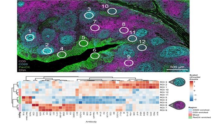 High_Plex_Spatial_Profiling_of_Proteins_and_RNA_from_FFPE_Partner_NanoString