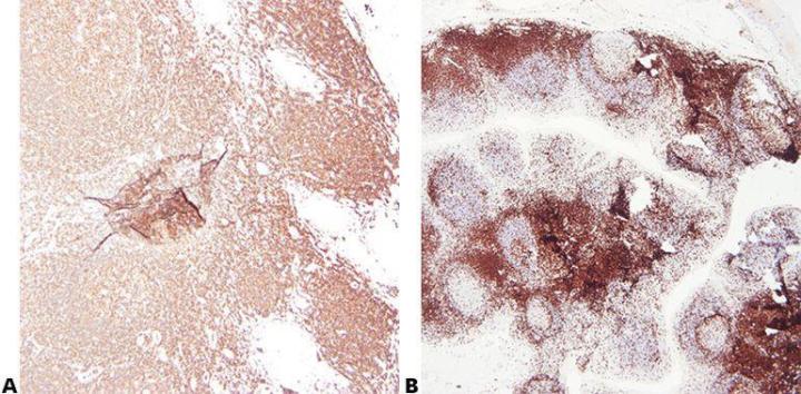 Inmunohistoquímica: Visión general y pasos a seguir para una mejor tinción IHC