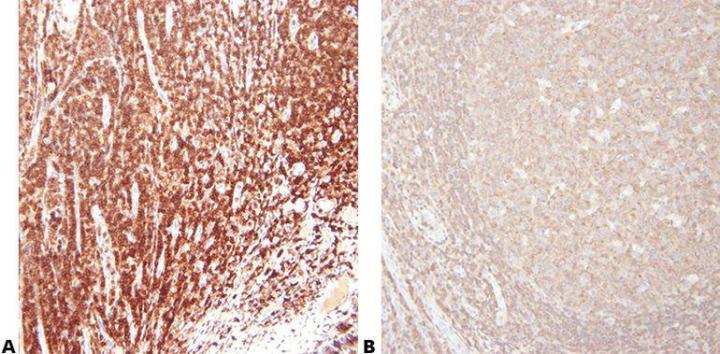 Inmunohistoquímica: Visión general y pasos a seguir para una mejor tinción IHC