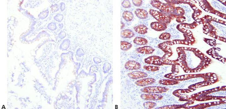 已对这些小肠切片进行细胞角蛋白 AE1/AE3 染色。 每张切片使用不同的抗原修复条件。 切片 A 显示不符合要求的弱染色，而切片 B 显示出强烈的精确染色。