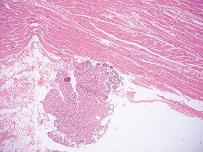 Tránh lây nhiễm chéo