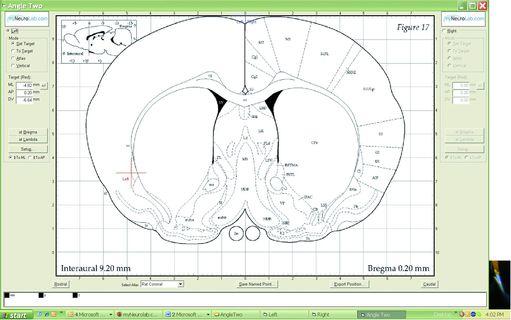 The screen shows, whre the probe tip is above or in the brain as the operator moves it towards the target. The screen shows, whre the probe tip is above or in the brain as the operator moves it towards the target.