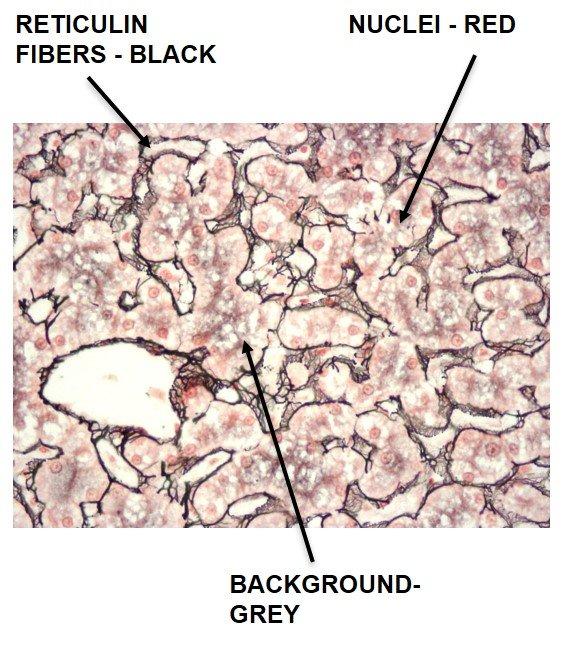 figure 11 special stains