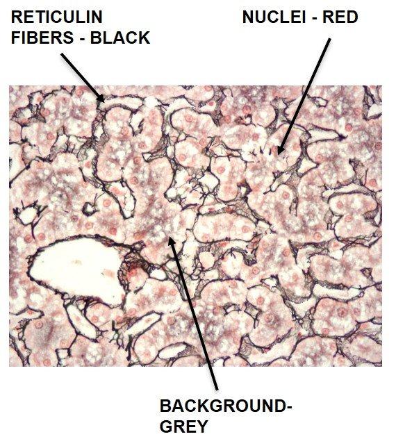 figure 11 special stains