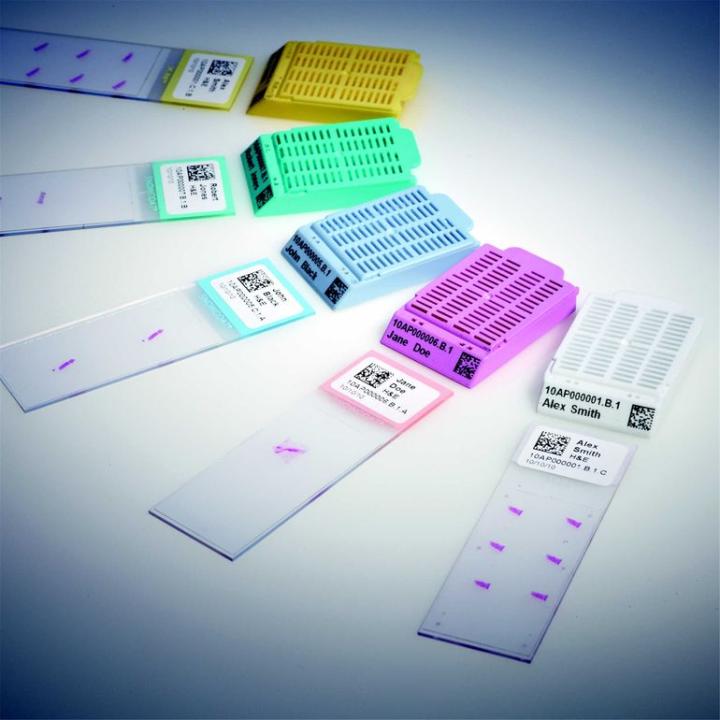 Figure 5: Clear and permanent barcoded labels