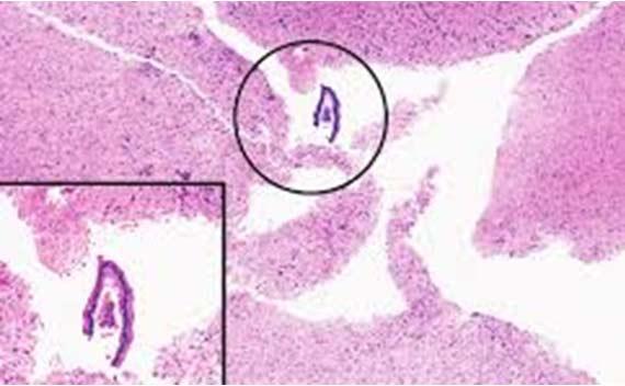 Información fundamental sobre la tinción Hematoxilina-Eosina (H&E), Parte 4: Resolución de problemas con las tinciones con H&E