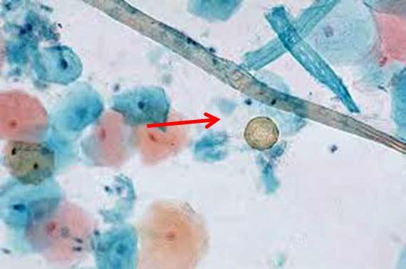 Información fundamental sobre la tinción Hematoxilina-Eosina (H&E), Parte 4: Resolución de problemas con las tinciones con H&E