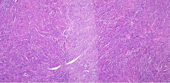 Información fundamental sobre la tinción Hematoxilina-Eosina (H&E), Parte 4: Resolución de problemas con las tinciones con H&E