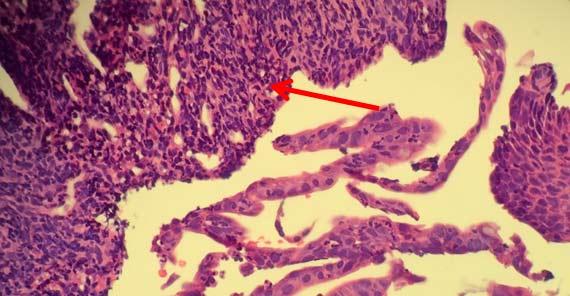 Información fundamental sobre la tinción Hematoxilina-Eosina (H&E), Parte 4: Resolución de problemas con las tinciones con H&E