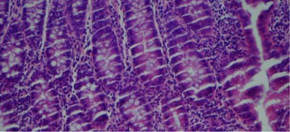 Información fundamental sobre la tinción Hematoxilina-Eosina (H&E), Parte 4: Resolución de problemas con las tinciones con H&E