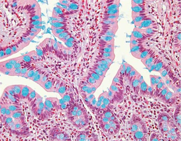 Figure 3: Colon stained with Alcian Blue