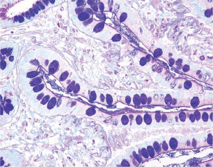 Figure 4: Colon stained with Alcian Blue/PAS