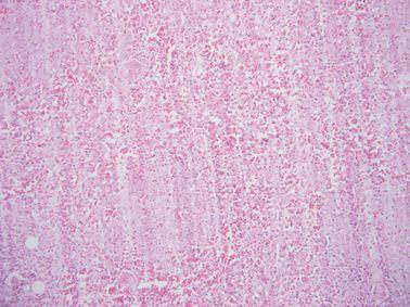 Einführung in die Mikrotomie: Vorbereitung & Schneiden Paraffin-eingebetteter Gewebe