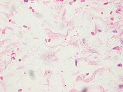 Einführung in die Mikrotomie: Vorbereitung & Schneiden Paraffin-eingebetteter Gewebe