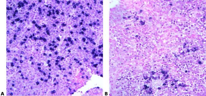 Both sections of tonsil were stained using ISH (BCIP/NBT) for kappa light chain mRNA using oligonucleotide probes from different sources. Section A shows strong staining while section B demonstrates weaker staining with fewer cells stained.