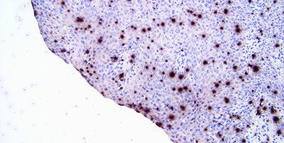 This section of tonsil stained with ISH for kappa light chain has dried out during the formamide post hybridization wash causing inconsistent, non-specific staining.