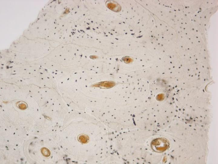Figure 1: An unstained ground section of compact bone. A number of osteons (Haversian systems) are cut transversely. The osteons consist of concentric layers of bone (lamelle) surrounding a central Haversian canal containing blood vessels. Within the lamelle are lacunae (spaces) normally containing osteocytes. In dried ground sections such as this they appear as black structures due to particles of abrasive and air contained within them. Figure 1: An unstained ground section of compact bone. A number of osteons (Haversian systems) are cut transversely. The osteons consist of concentric layers of bone (lamellae) surrounding a central Haversian canal containing blood vessels. Within the lamellae are lacunae (spaces) normally containing osteocytes. In dried ground sections such as this, they appear as black structures due to particles of abrasive and air contained within them.