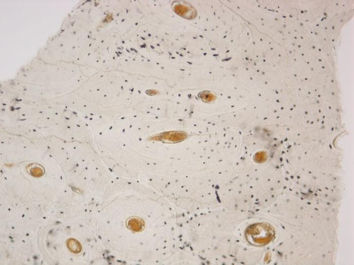 Figure 1: An unstained ground section of compact bone. A number of osteons (Haversian systems) are cut transversely. The osteons consist of concentric layers of bone (lamellae) surrounding a central Haversian canal containing blood vessels. Within the lamellae are lacunae (spaces) normally containing osteocytes. In dried ground sections such as this, they appear as black structures due to particles of abrasive and air contained within them.