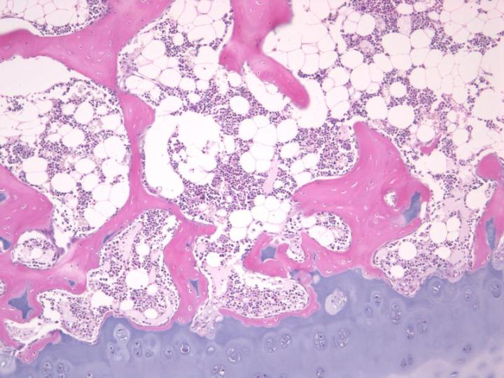 Figure 4: A decalcified section of cancellous bone (pink) and hyaline cartilage (blue) from the epiphysis of a long bone (H&E). The delicate trabeculae of the bone are well preserved, as is the fine structure of the bone marrow and associated adipocytes. The basophilic/acidophilic balance of the stain is well maintained indicating that the formic acid decalcification was optimal.