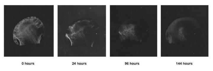 Hình 8: Chuỗi ảnh chụp X-quang sau quá trình khử keo đầu xương đùi bằng chất khử keo axit formic/citrate. Các ảnh chụp X quang được tạo ra bằng cách sử dụng Hewlett-Packard Faxitron® và cho phép thực hiện chính xác quy trình cũng như xác định chính xác điểm cuối.
