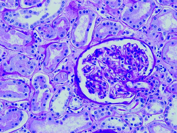Figure 10: Periodic Acid Schiff (kidney). PAS staining is mainly used for staining structures containing a high proportion of carbohydrates such as glycogen,glycoproteins, proteoglycans typically found in connective tissues, mucus and basement membranes. Often used to stain kidney biopsies, liver biopsies, certain glycogen storage diseases in striated muscles and suspected fungal infections. Periodic Acid Schiff (PAS) staining is mainly used for staining structures containing a high proportion of carbohydrates such as glycogen,glycoproteins, proteoglycans typically found in connective tissues, mucus and basement membranes. Often used to stain