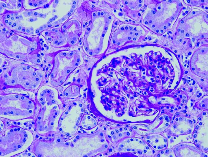 Periodic Acid Schiff (PAS) staining is mainly used for staining structures containing a high proportion of carbohydrates such as glycogen,glycoproteins, proteoglycans typically found in connective tissues, mucus and basement membranes. Often used to stain