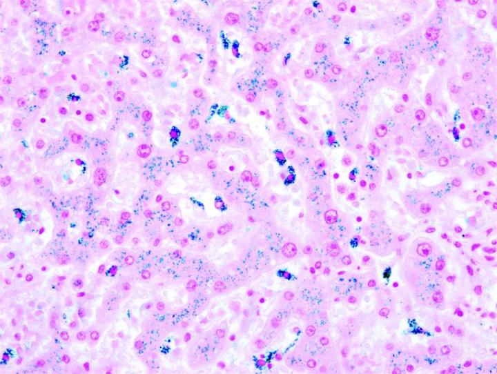 Figure 11: Perls’ Prussian Blue Iron (liver). This stain is used to detect and identify ferric (Fe3+) iron in tissue preparations, blood smears,or bone marrow smears. Minute amounts of ferric iron (haemosiderin) are commonly found in bone marrow and in the spleen. Abnormal amounts of iron can indicate hemochromatosis and hemosiderosis. Perls’ Prussian Blue Iron stains are used to detect and identify ferric (Fe3+) iron in tissue preparations, blood smears,or bone marrow smears. Minute amounts of ferric acid are commonly found in bone marrow and in the spleen. Abnormal amounts of iron c