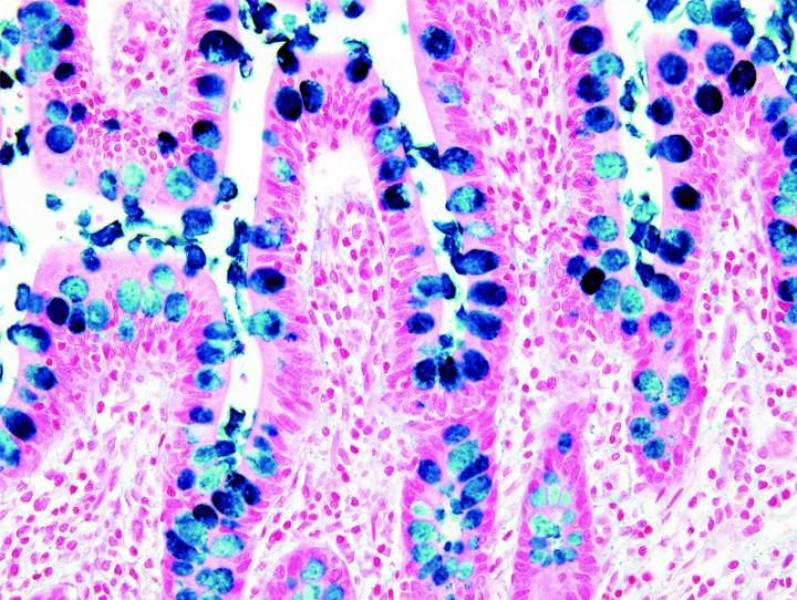 Figure 13: Alcian Blue (intestine). Alcian Blue is normally prepared at pH 2.5 and is used to identify acid mucopolysaccharides and acidic mucins. Excessive amounts of non-sulfated acidic mucosubstances are seen in mesotheliomas, certain amounts occur normally in blood vessel walls, but increase in early lesions of atherosclerosis. Alcian Blue is normally prepared at an acidic pH of 2.5 and is used to identify acid mucopolysaccharides and acetic mucins. Excessive amounts of non-sulfated acidic mucosubstances are seen in mesotheliomas, certain amounts occur normally in blood vessel w