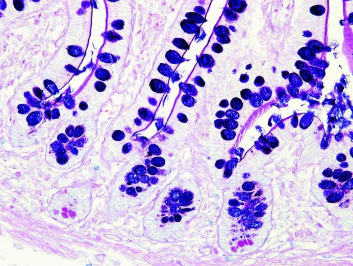 Alcian Blue and PAS combines the properties of both Alcian Blue and Periodic Acid Schiff staining.