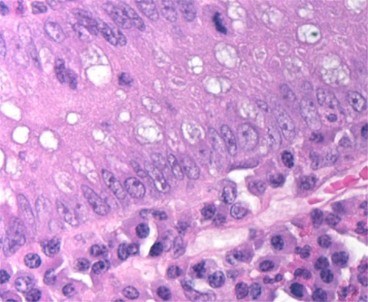 Phần này từ niêm mạc ruột non cho thấy chất dị nhiễm sắc và nucleoli được xác định rõ ràng trong các tế bào biểu mô và tế bào plasma trong lớp đệm.