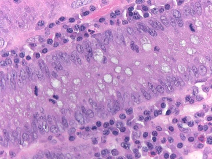 Mitotic figures are sharply stained within the glandular epithelium in a section of small intestine