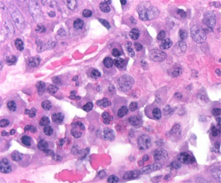 In this field from the lamina propria of small intestine, the cytoplasm of plasma cells has stained with hematoxylin except for the pale peri-nuclear area, which corresponds with a well-developed Golgi apparatus